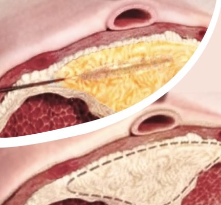 UROLOGIA-min